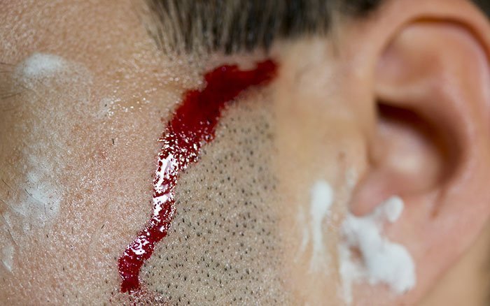 Du hast Dich beim Rasieren geschnitten? Ich zeige Dir, wie Du die Blutung stoppst und Verletzungen in Zukunft verhinderst. Du hast Dich beim Rasieren geschnitten? Ich zeige Dir, wie Du die Blutung stoppst und Verletzungen in Zukunft verhinderst.