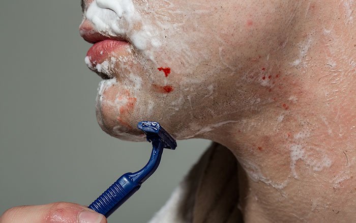 10 Tipps, wie Du Rasurbrand effektiv vermeiden kannst 10 Tipps, wie Du Rasurbrand effektiv vermeiden kannst